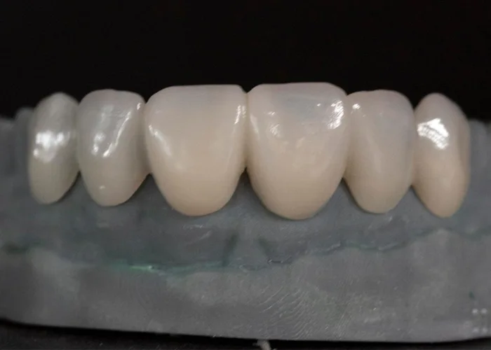 Image5-SHT Color Zirconia Disc
